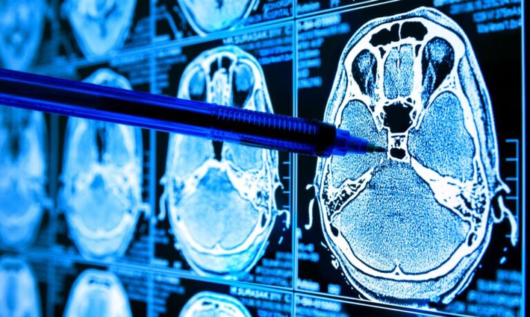 Ochronę zdrowia czeka boom na sztuczną inteligencję. Rynek jest wart miliardy dolarów Ochronę zdrowia czeka boom na sztuczną inteligencję. Rynek jest wart miliardy dolarów