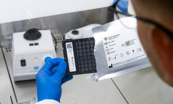 Córka Scope Fluidics zawarła porozumienie o sprzedaży BACTEROMIC w Rumunii.