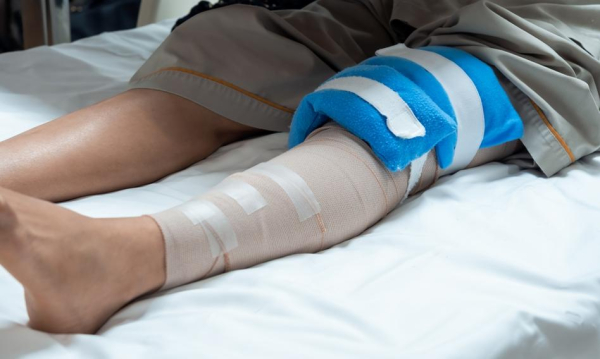 W ciągu jednego dnia: 167 przypadków złamań. Szpital odwołuje planowe przyjęcia.