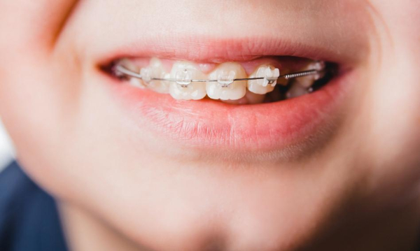 Prosty zgryz? Cena zaskakuje.